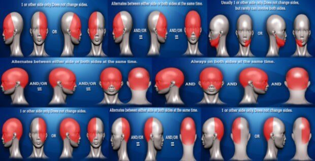 headache chart with location of headache chart meaning