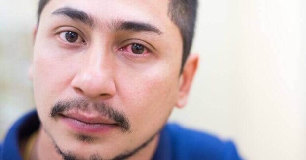 one-sided-headache-with-congested-runny-nose-5-reasons-why-virtual