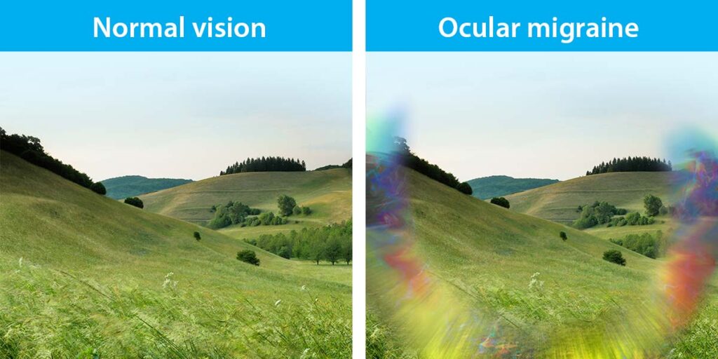 Migraine Vision Blur Migraine Ophtalmique Causes Sympt mes Et Migraine Vision Blur Migraine Ophtalmique Causes Sympt mes Et