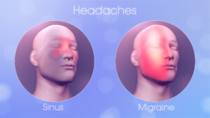 Sinus-Headache-vs-Migraine