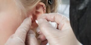 how-is-daith-piercing-for-migraine-done