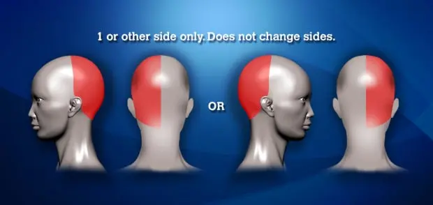 Occipital neuralgia, back of head pain headache, pain in back of head, headache chart