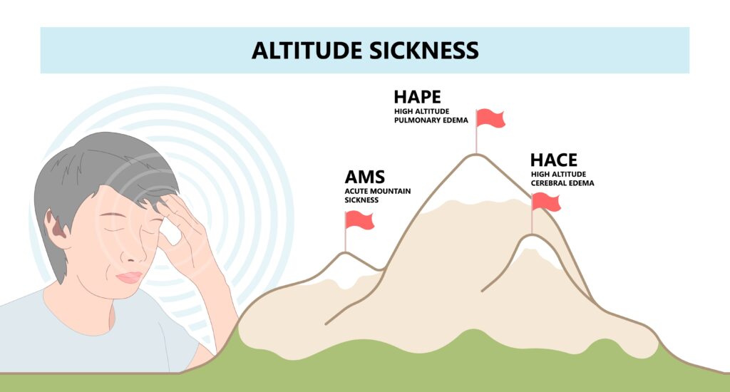 Altitude headache, 3 stages of altitude sickness, acute mountain sickness, high altitude pulmonary edema, high altitude cerebral edema
